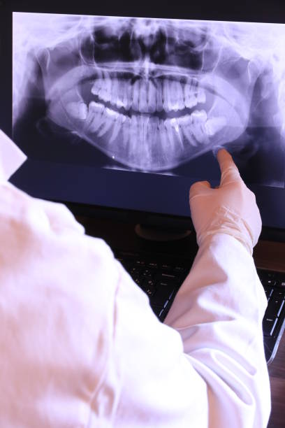 Best Emergency Dental Extractions in Merrill, IA