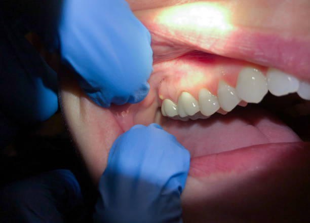 Best Broken or Cracked Tooth Emergency Dentist in Merrill, IA